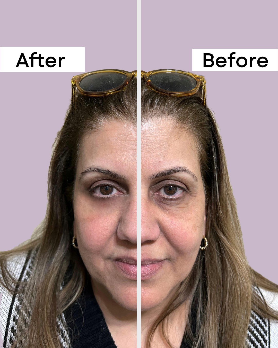 Instant Lift Eye Cream
