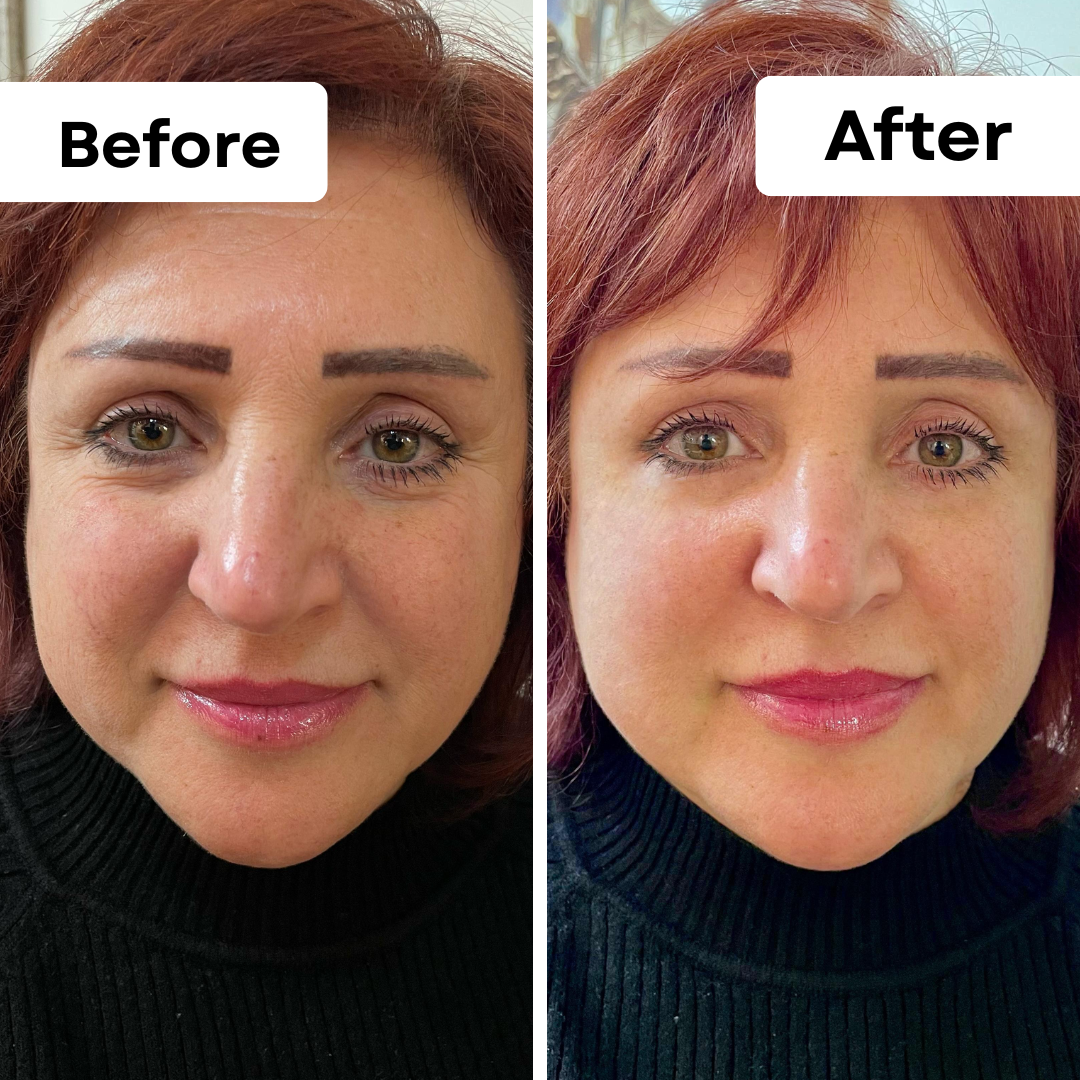 Instant Lift Eye Cream